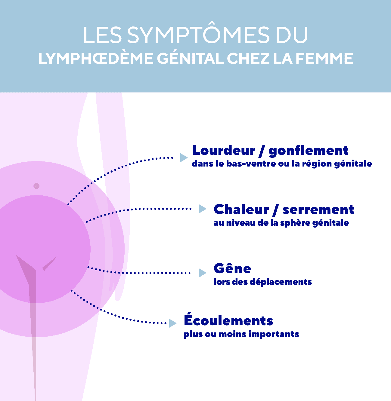 IMG Le lymphœdème génital chez la femme