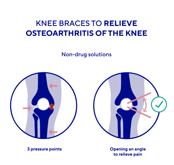 Knee braces to relieve osteoarthritis of the knee