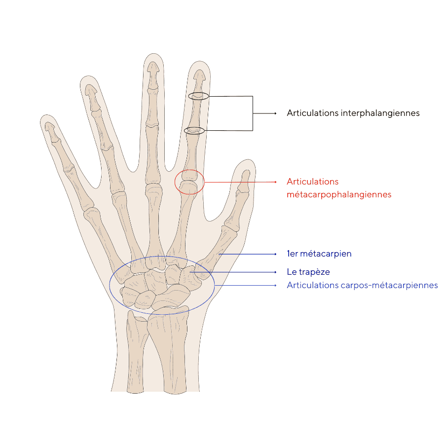 Schema arthrose du pouce
