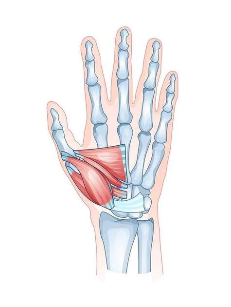 Thumb sprain 2.jpg