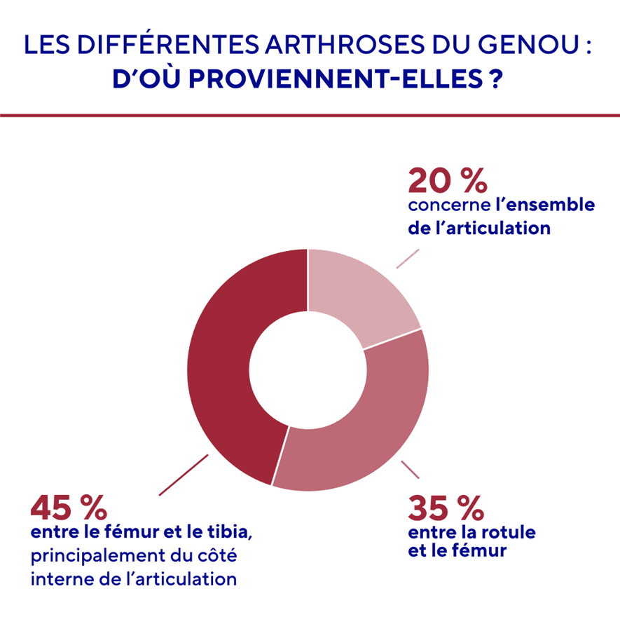d'où viennent les arthroses du genou.png