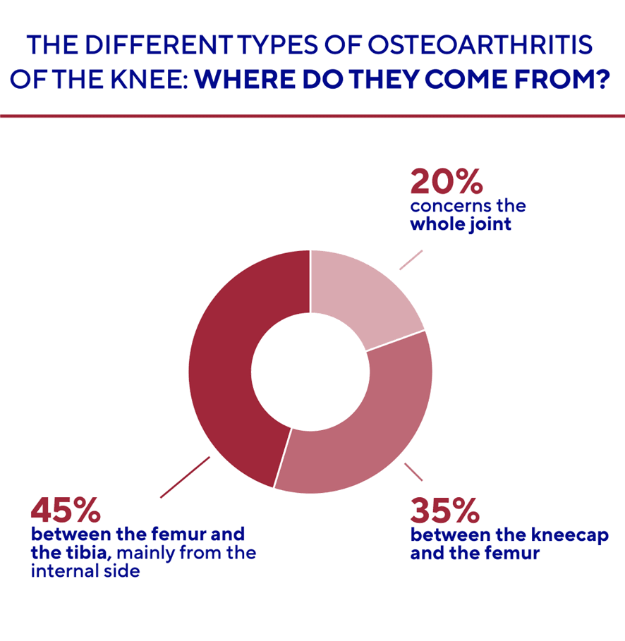 different-types-of-osteoarthritis.png