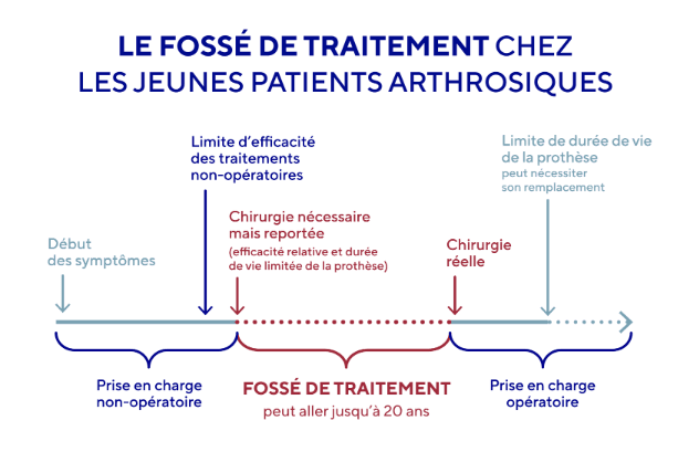 Le fossé de traitement chez les jeunes patients arthrosiques