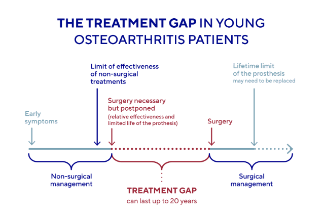 osteoarthritis treatment gap young adults