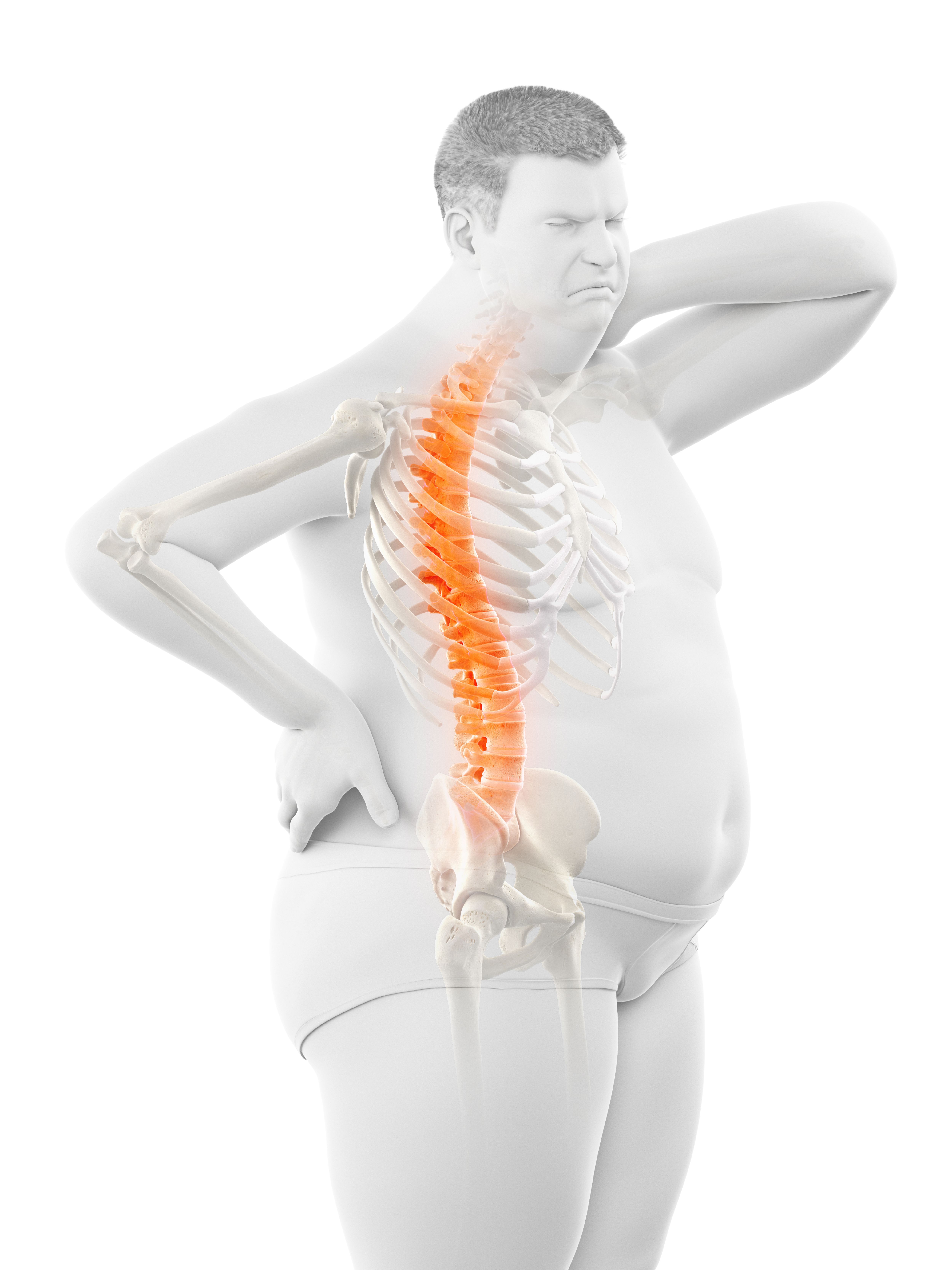 weight back pain