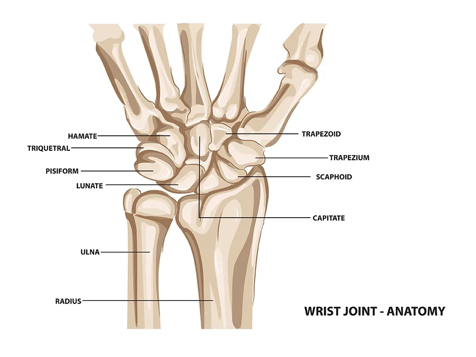 wrist_sprain_schema.webp